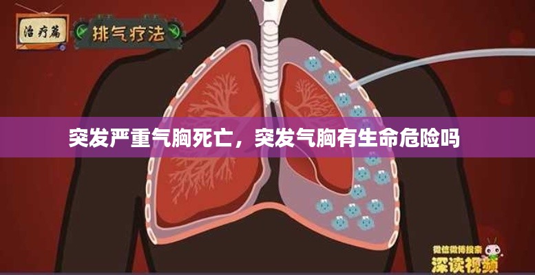 突发严重气胸死亡,突发气胸有生命危险吗