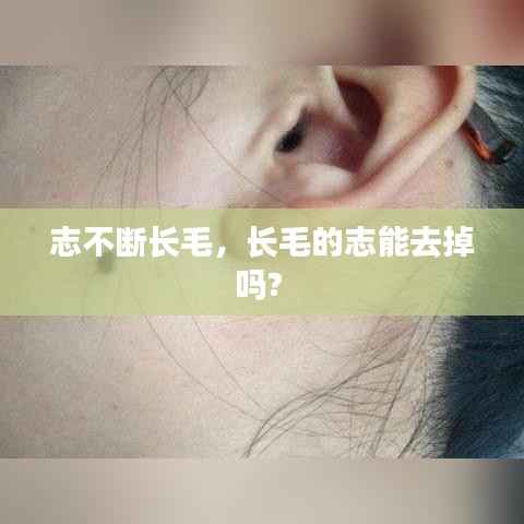 志不断长毛,长毛的志能去掉吗?
