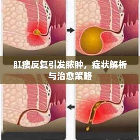 肛瘘反复引发脓肿,症状解析与治愈策略